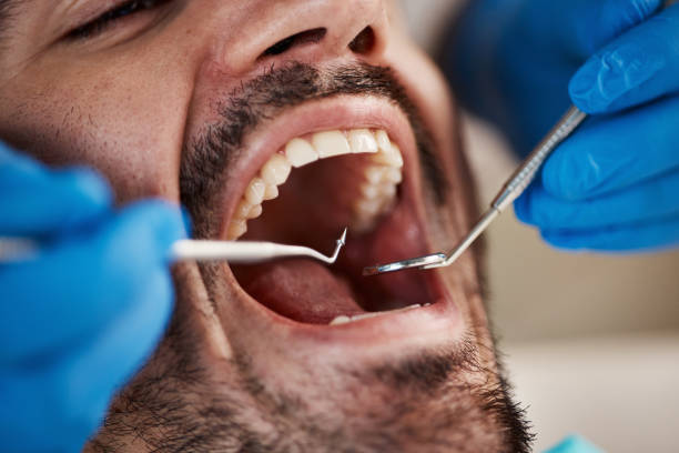Best Cosmetic Emergency Dentistry in Unionville, MO
